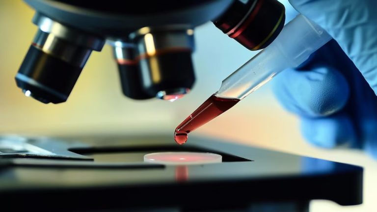 Un nuevo análisis de sangre podría detectar el riesgo de leucemia y evitar métodos invasivos de diagnóstico