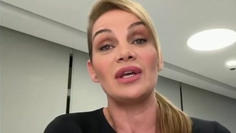 El tratamiento estético de Eliana Guercio bajo la mirada de los expertos: cómo prevenir riesgos