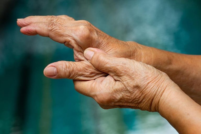 Descubren señales tempranas de artritis reumatoide antes de que aparezcan los síntomas